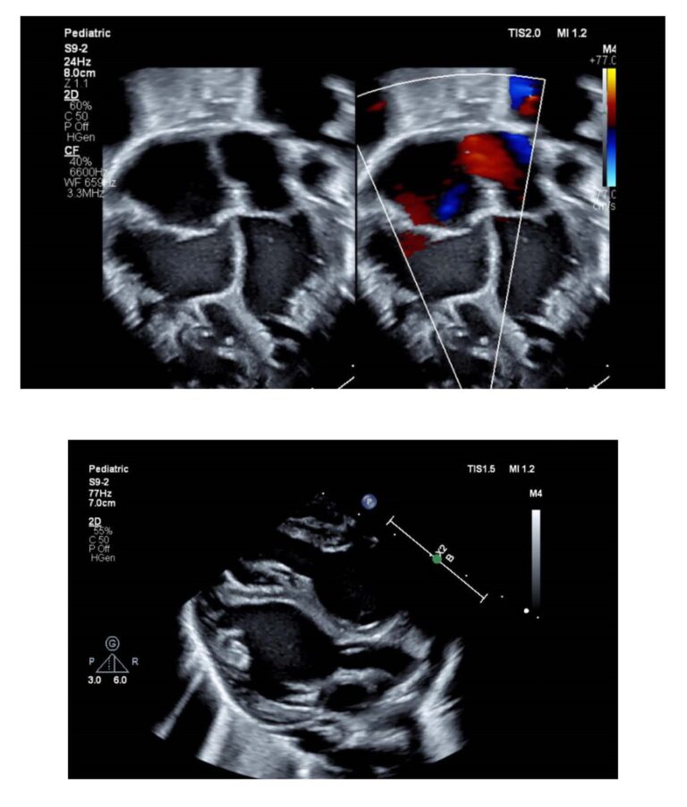 Qow 472 - Congenital Cardiac Anesthesia Society